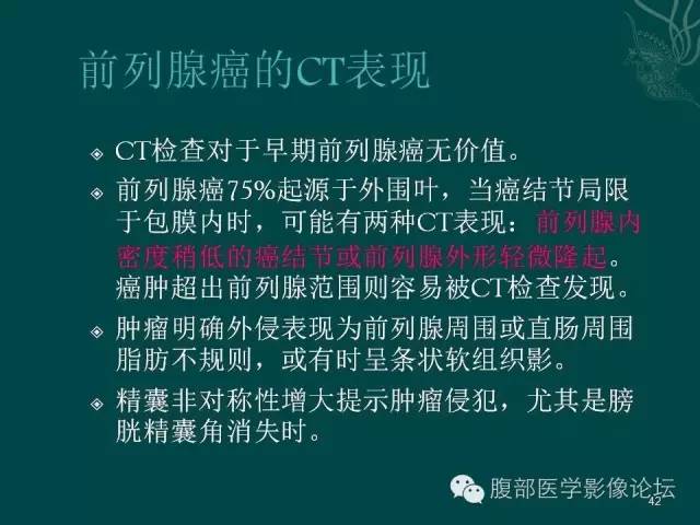 【PPT】盆腔病变的CT诊断