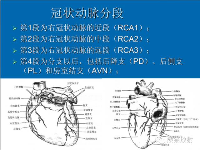 【PPT】冠状动脉解剖 【PPT】冠状动脉解剖