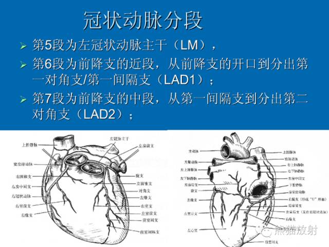 【PPT】冠状动脉解剖 【PPT】冠状动脉解剖