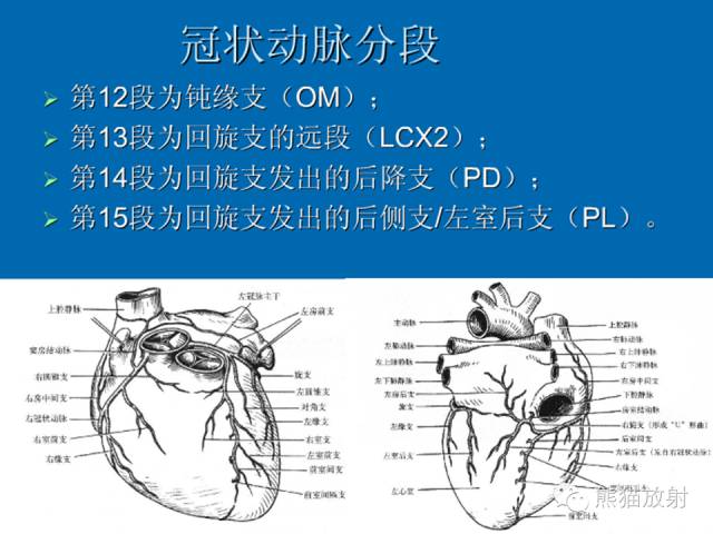 【PPT】冠状动脉解剖 【PPT】冠状动脉解剖