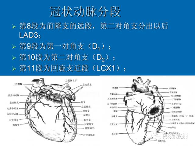 【PPT】冠状动脉解剖 【PPT】冠状动脉解剖