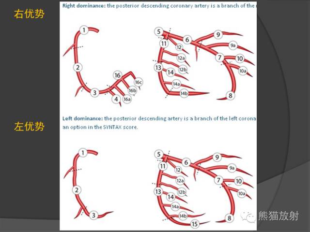 【PPT】冠状动脉解剖 【PPT】冠状动脉解剖