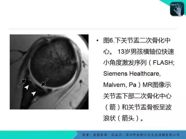 【PPT】儿童肩关节正常骨骼发育和影像诊断陷阱