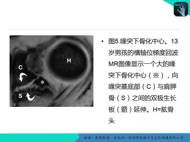 【PPT】儿童肩关节正常骨骼发育和影像诊断陷阱
