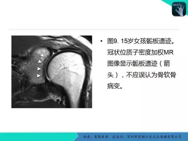 【PPT】儿童肩关节正常骨骼发育和影像诊断陷阱