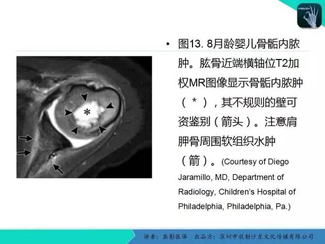 【PPT】儿童肩关节正常骨骼发育和影像诊断陷阱