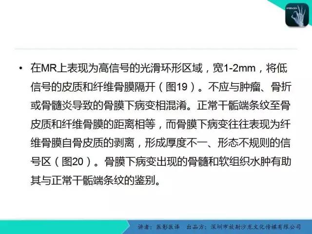 【PPT】儿童肩关节正常骨骼发育和影像诊断陷阱