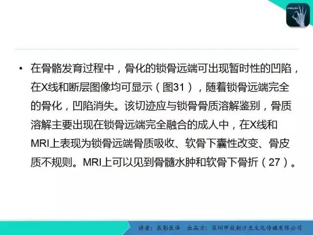 【PPT】儿童肩关节正常骨骼发育和影像诊断陷阱