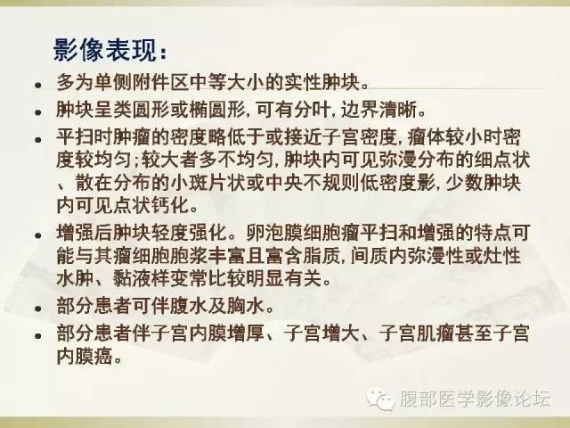 【病例】卵巢纤维卵泡膜细胞瘤1例CT影像表现 【病例】卵巢纤维卵泡膜细胞瘤1例CT影像表现