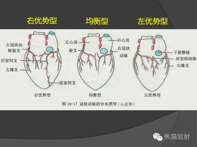 【PPT】冠状动脉的优势判断、起源异常及心肌桥