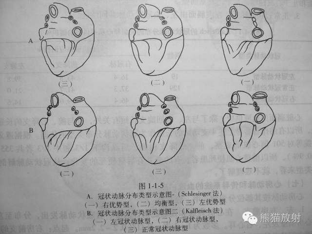【PPT】冠状动脉的优势判断、起源异常及心肌桥