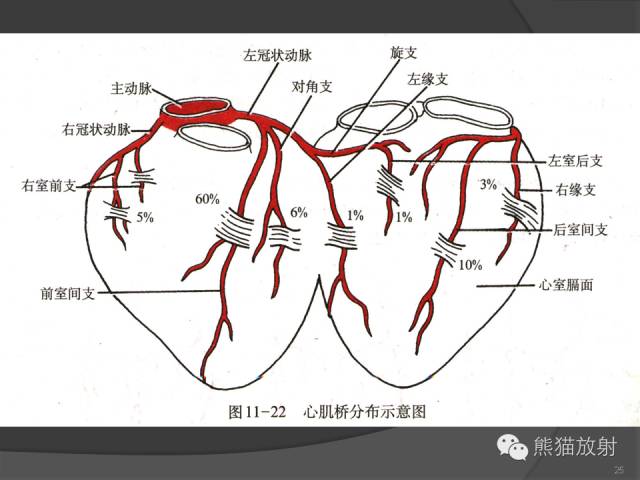 【PPT】冠状动脉的优势判断、起源异常及心肌桥