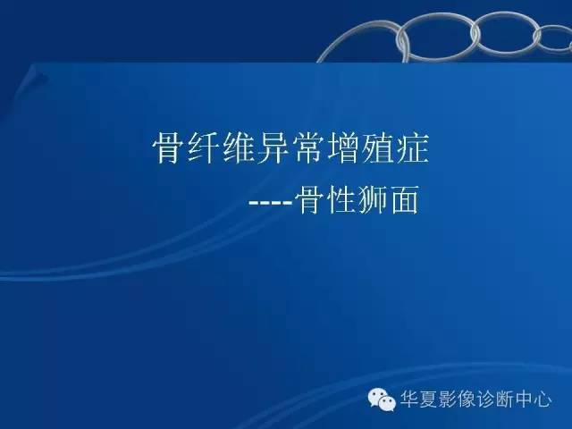 【PPT】骨纤维异常增殖症——骨性狮面