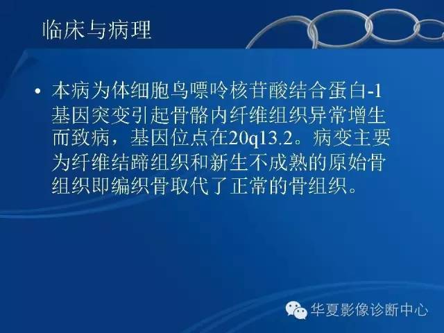 【PPT】骨纤维异常增殖症——骨性狮面