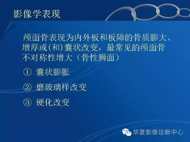 【PPT】骨纤维异常增殖症——骨性狮面