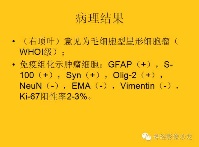【病例】幕上毛细胞型星形细胞瘤1例MR影像表现