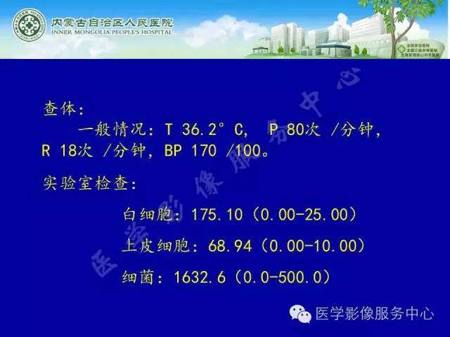 【病例】深在性囊性胃炎1例CT影像表现 【病例】深在性囊性胃炎1例CT影像表现