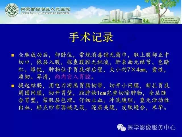 【病例】深在性囊性胃炎1例CT影像表现 【病例】深在性囊性胃炎1例CT影像表现