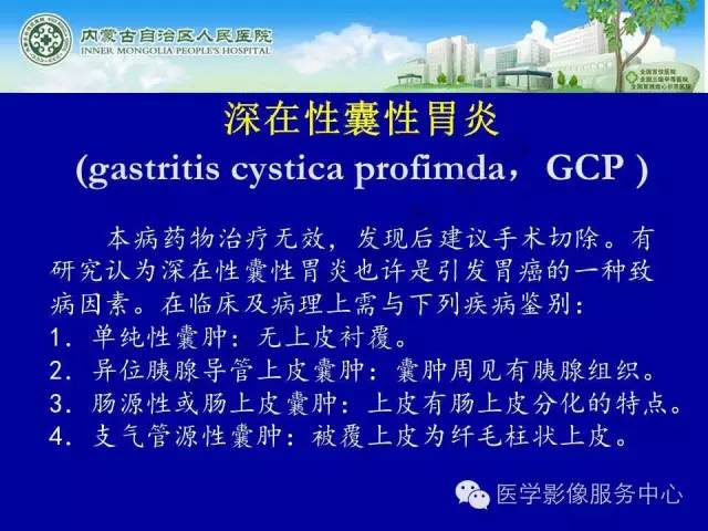 【病例】深在性囊性胃炎1例CT影像表现 【病例】深在性囊性胃炎1例CT影像表现