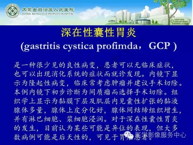 【病例】深在性囊性胃炎1例CT影像表现 【病例】深在性囊性胃炎1例CT影像表现