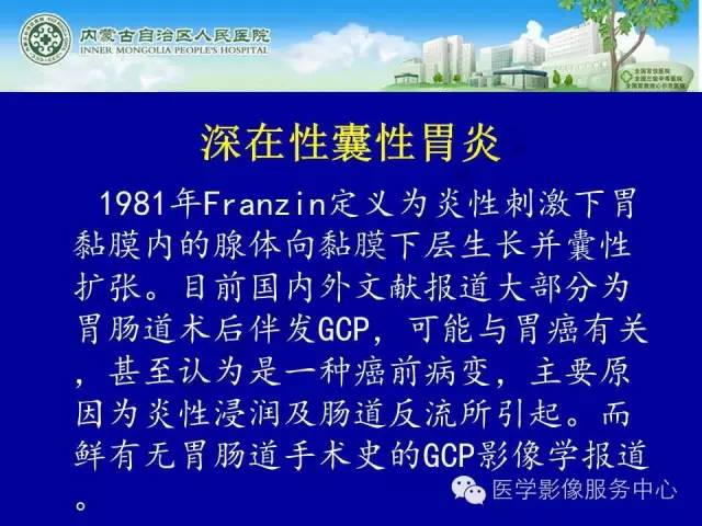 【病例】深在性囊性胃炎1例CT影像表现 【病例】深在性囊性胃炎1例CT影像表现