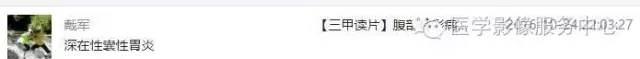 【病例】深在性囊性胃炎1例CT影像表现 【病例】深在性囊性胃炎1例CT影像表现