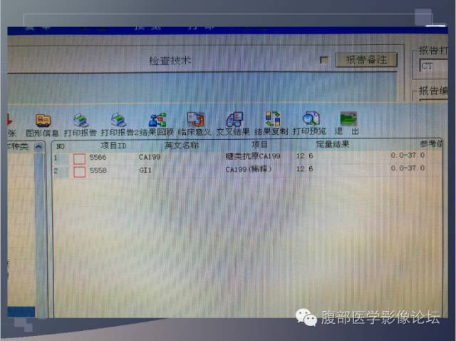 【病例】胰头神经内分泌肿瘤1例CT影像表现 【病例】胰头神经内分泌肿瘤1例CT影像表现