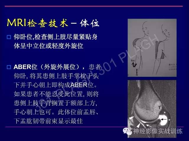 【PPT】肩关节撞击综合征的磁共振诊断