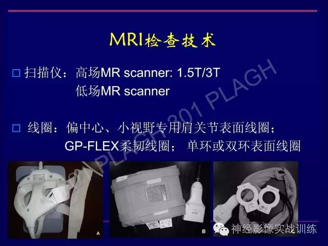 【PPT】肩关节撞击综合征的磁共振诊断
