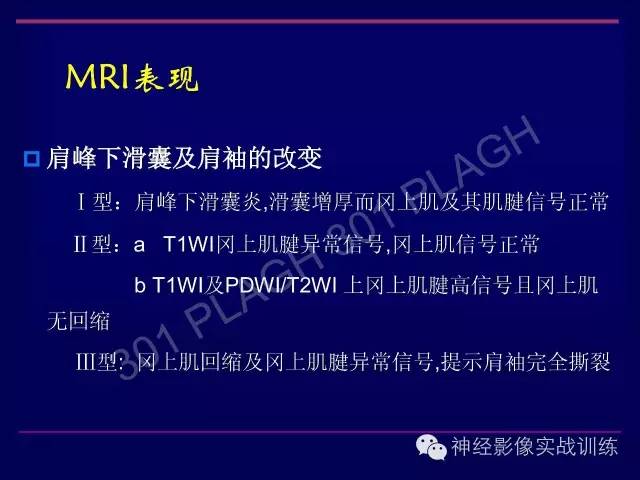 【PPT】肩关节撞击综合征的磁共振诊断