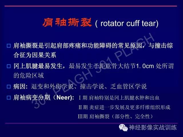 【PPT】肩关节撞击综合征的磁共振诊断