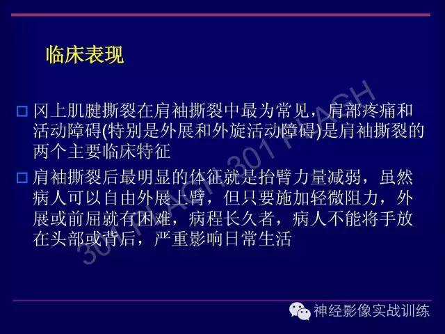【PPT】肩关节撞击综合征的磁共振诊断