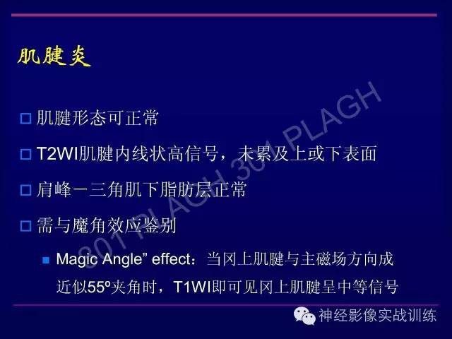 【PPT】肩关节撞击综合征的磁共振诊断