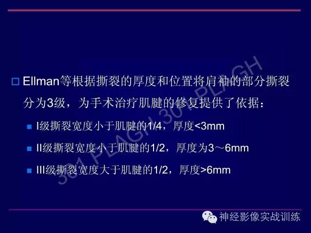 【PPT】肩关节撞击综合征的磁共振诊断