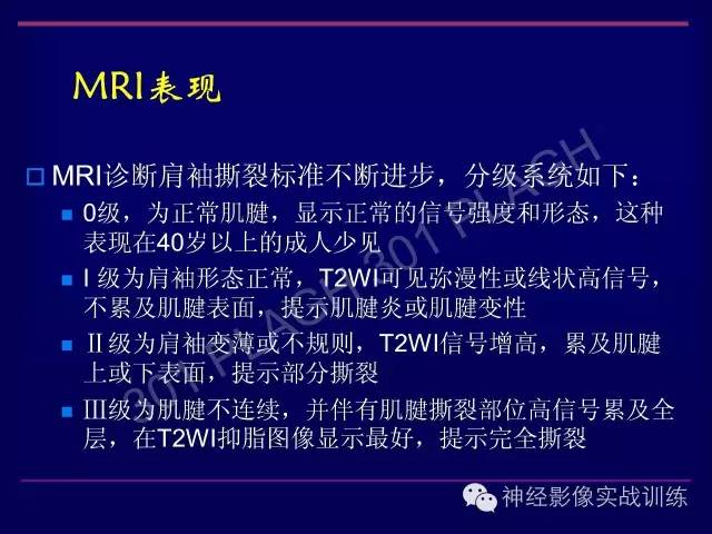 【PPT】肩关节撞击综合征的磁共振诊断