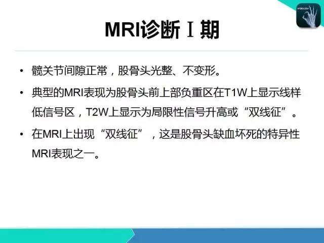 【PPT】股骨头缺血性坏死