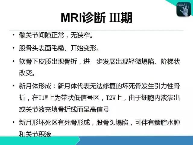 【PPT】股骨头缺血性坏死