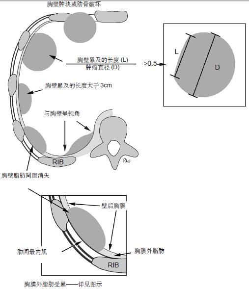 原发性肺部肿瘤的可切除性:影像学评估 原发性肺部肿瘤的可切除性:影像学评估