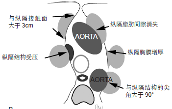 原发性肺部肿瘤的可切除性:影像学评估 原发性肺部肿瘤的可切除性:影像学评估