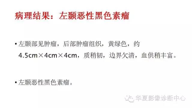 【病例】左颞叶恶性黑色素瘤1例MR影像分析