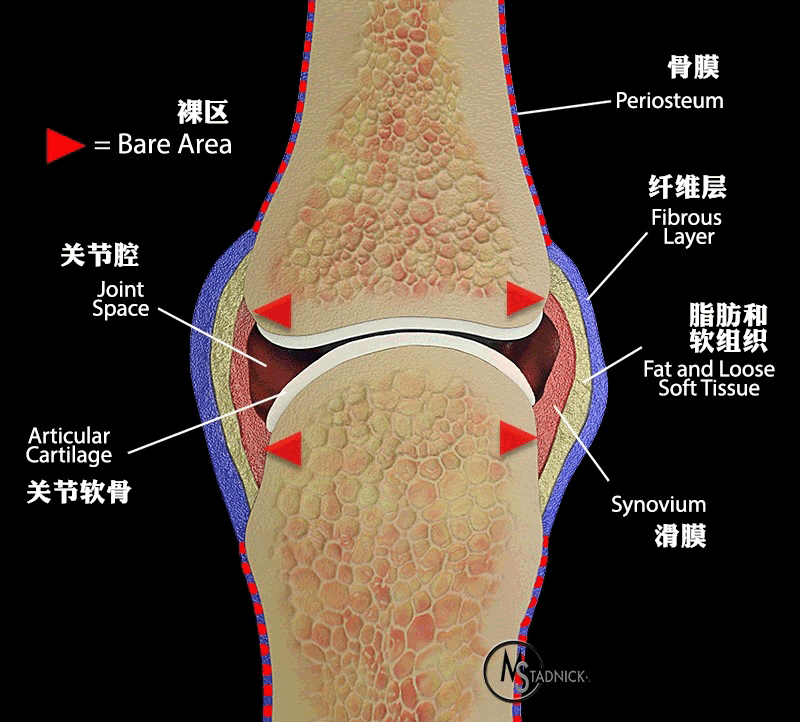 【病例】类风湿关节炎1例MRI诊断分析 【病例】类风湿关节炎1例MRI诊断分析