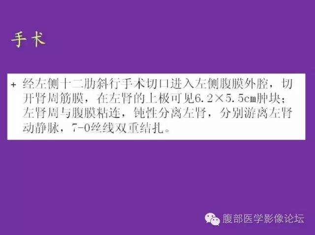 【病例】后肾腺瘤1例CT影像诊断与鉴别 【病例】后肾腺瘤1例CT影像诊断与鉴别