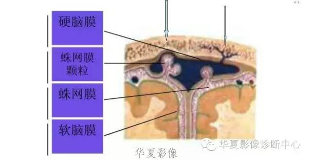 硬膜外还是硬膜下出血，你分清了吗？