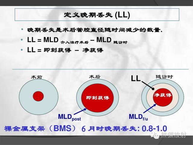 【PPT】冠状动脉支架及搭桥术后的评估