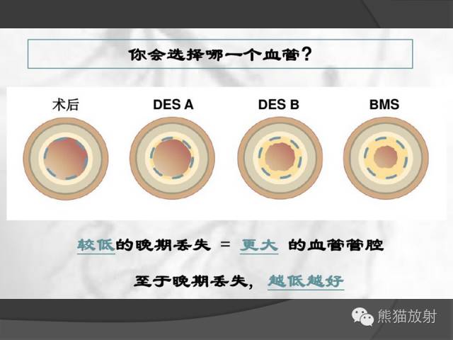 【PPT】冠状动脉支架及搭桥术后的评估