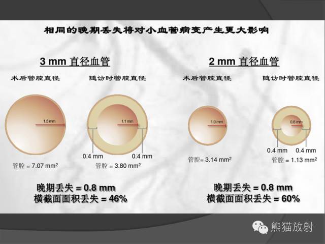 【PPT】冠状动脉支架及搭桥术后的评估