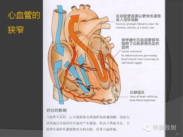 【PPT】冠状动脉支架及搭桥术后的评估
