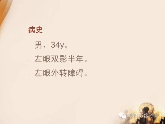 【病例】鞍旁脊索瘤1例CT及MR影像表现