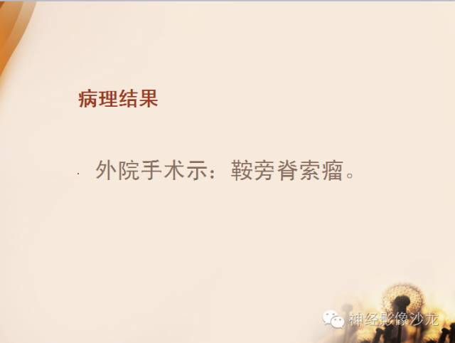 【病例】鞍旁脊索瘤1例CT及MR影像表现
