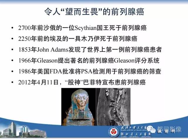 【PPT】前列腺癌高分辨率DWI临床应用
